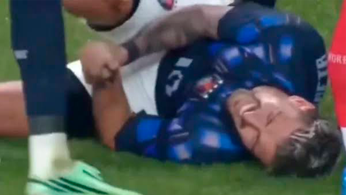 Flamengo confirma fratura no punho de Arrascaeta, e meia deve passar por cirurgia